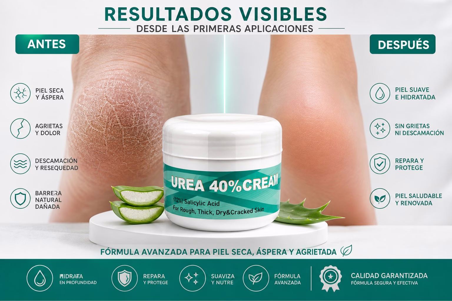 Resultado crema urea 40% antes y después — manos con dermatitis tratadas con Protepiel
